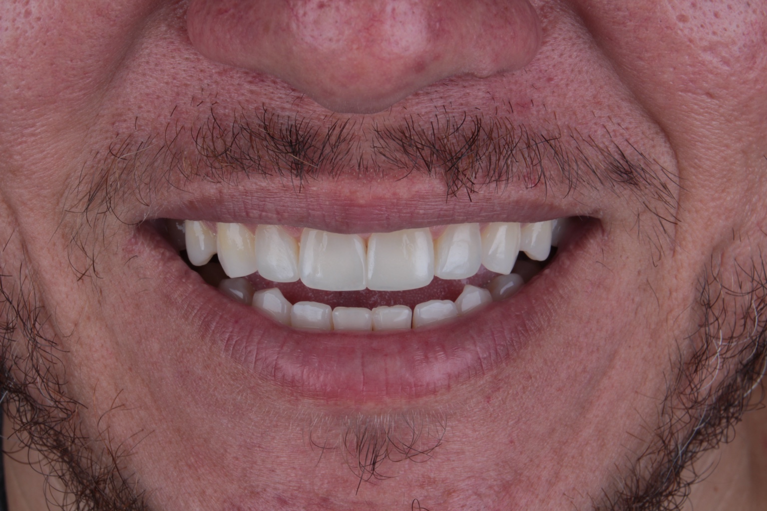 Fotografia clínica de sorriso, compartilhada pela FIANTTO